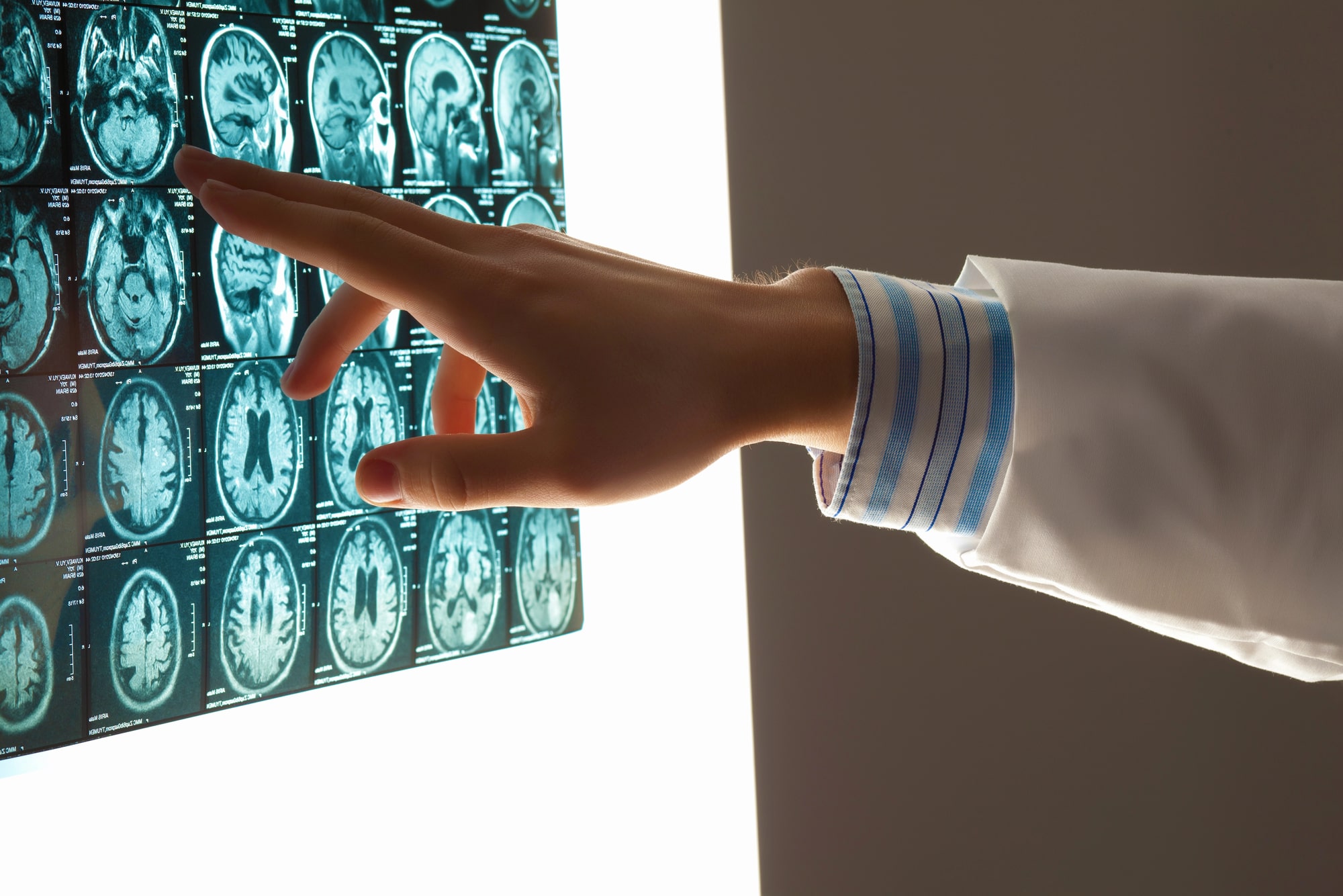 Help From A Brain Injury Lawyer